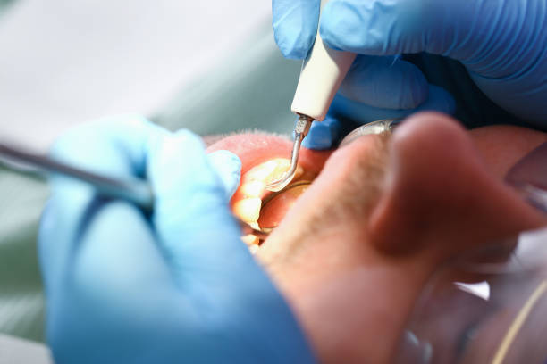 Best Dental Abscess Treatment in Sharon Hill, PA