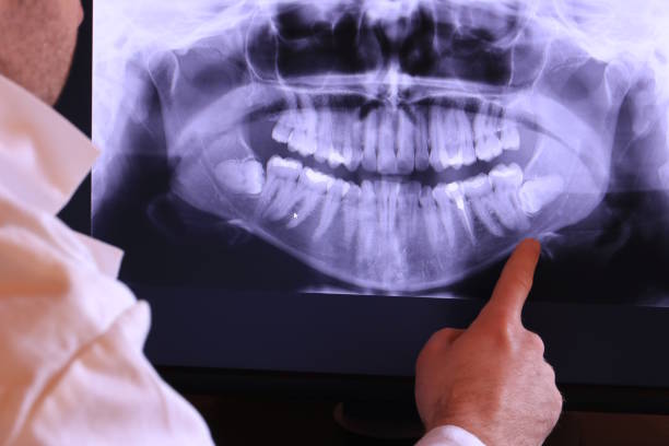 Best Broken or Chipped Tooth Repair in Sharon Hill, PA